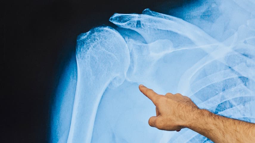 joint health and arthritis video